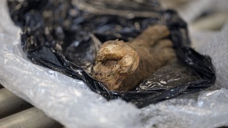 A real human foot, with flesh still attached, is pictured on an inspection table after it was discovered in a shipment in Philadelphia, Pa. (National Geographic)