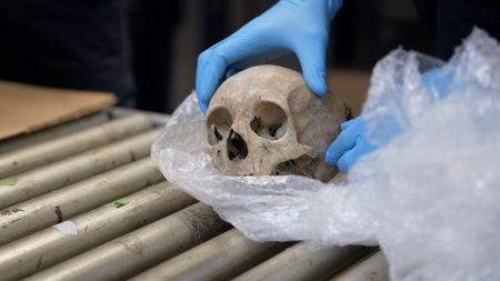 A real human skull was placed on an inspection table after it was discovered in a shipment in Philadelphia, Pa. (National Geographic)