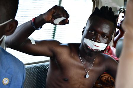 Music producer to Bobi Wine, Daniel Oyerwot with covered lips after they were hit and cut by a tear gas canister during the campaign trail of Bobi Wine in Kayunga on December 1, 2020. (photo credit: Lookman Kampala)