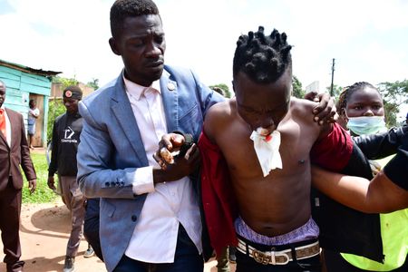 Bobi Wine, assists his music producer Dan Magic into a hospital in Kayunga, Uganda, after he was injured by police teargas canisters and rubber bullets used to disperse crowds on December 1, 2020.(photo credit: Lookman Kampala)